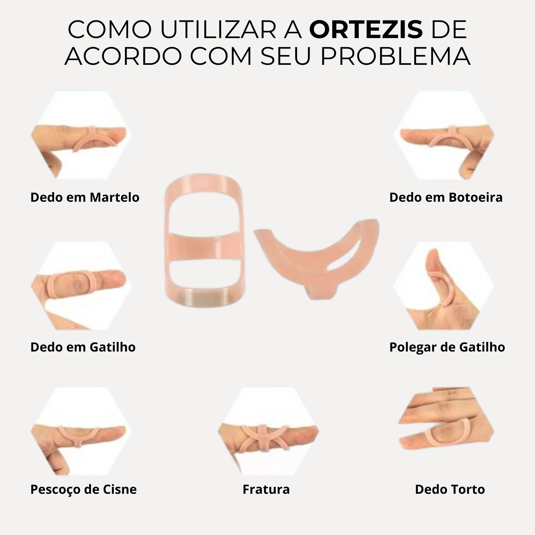 Ortezis
